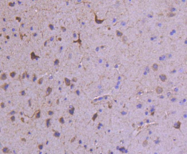 Glutamate receptor 1 Rabbit mAb