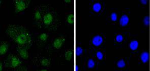 RelB Rabbit mAb
