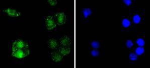 RelB Rabbit mAb
