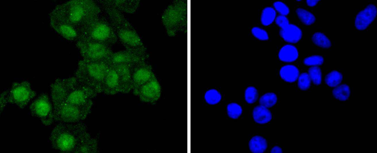 RelB Rabbit mAb
