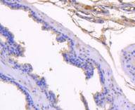 Prostate Specific Antigen Rabbit mAb
