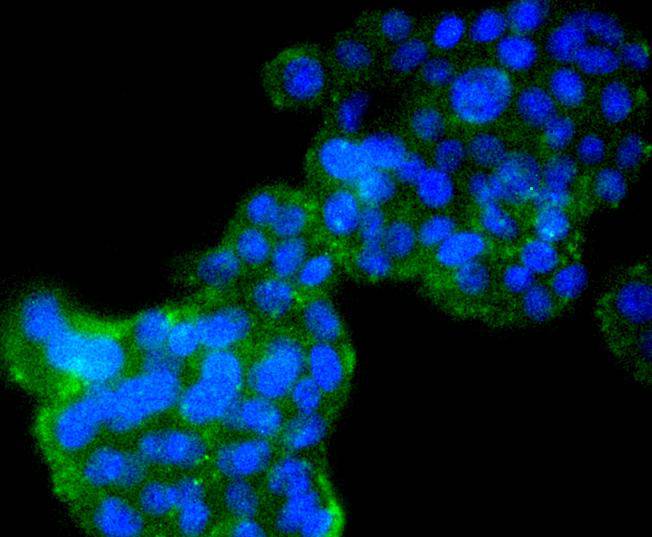 Cyclin B2 Rabbit mAb