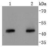 Cyclin B2 Rabbit mAb