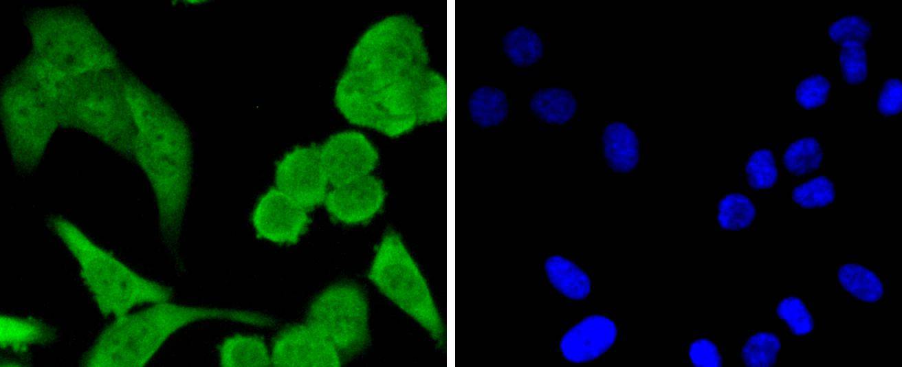 STAT1 alpha Rabbit mAb
