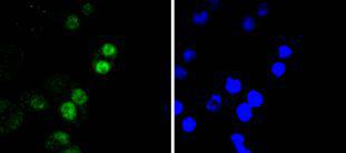 RUNX2 Rabbit mAb