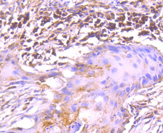TRK fused gene Rabbit mAb
