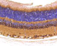 PAX6 Rabbit mAb