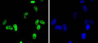 Cdk9 Rabbit mAb