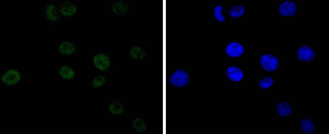 Cdk9 Rabbit mAb