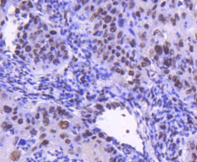 Cdk9 Rabbit mAb