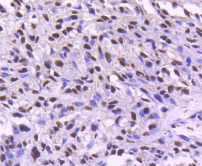 Cdk9 Rabbit mAb