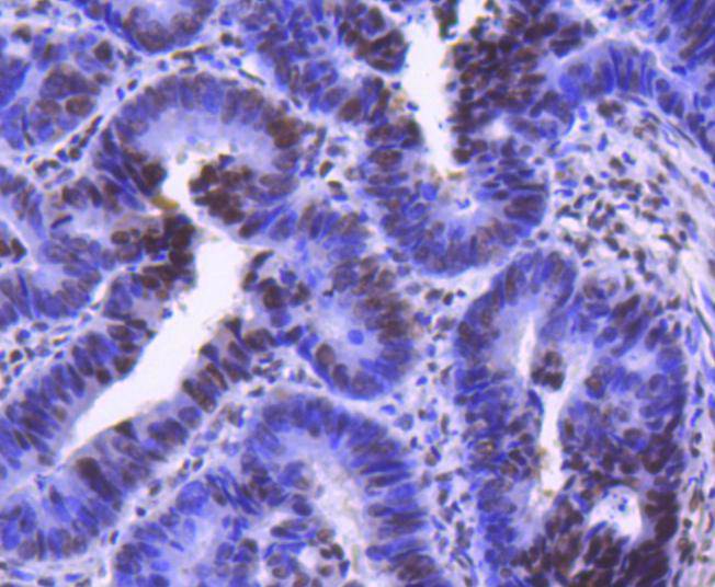 Cdk9 Rabbit mAb