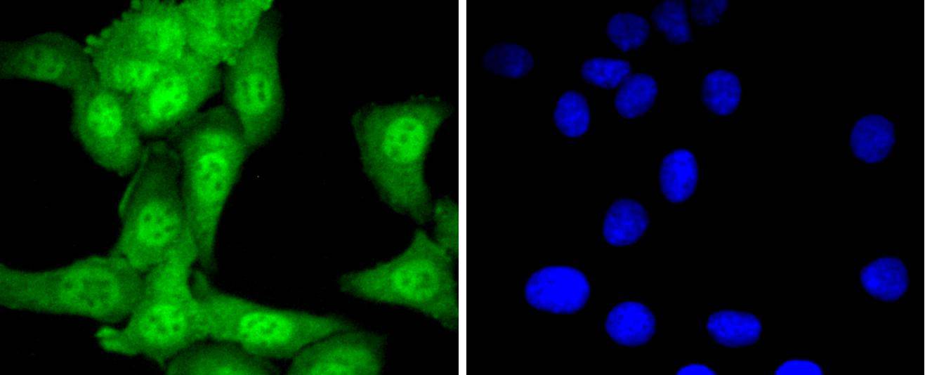 Ubiquitin-like modifier-activating enzyme 1 Rabbit mAb