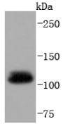 Ubiquitin-like modifier-activating enzyme 1 Rabbit mAb