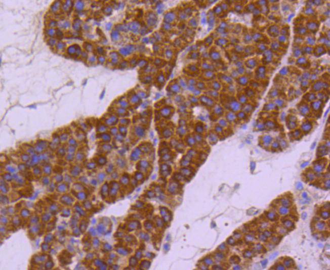 HSPA4 Rabbit mAb