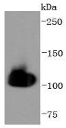 HSPA4 Rabbit mAb