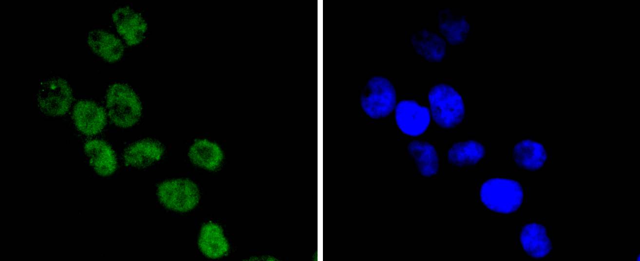 CDC40 Rabbit mAb