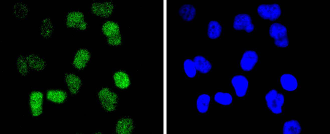 CDC40 Rabbit mAb