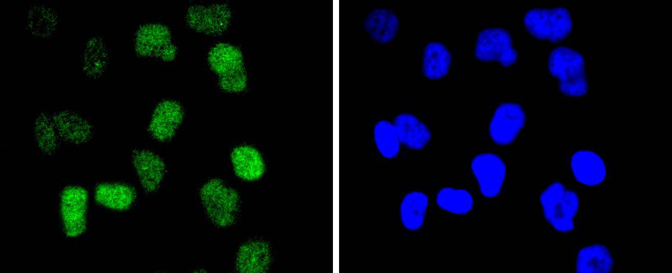 CDC40 Rabbit mAb