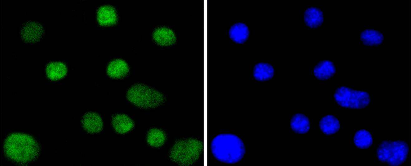 CDC40 Rabbit mAb