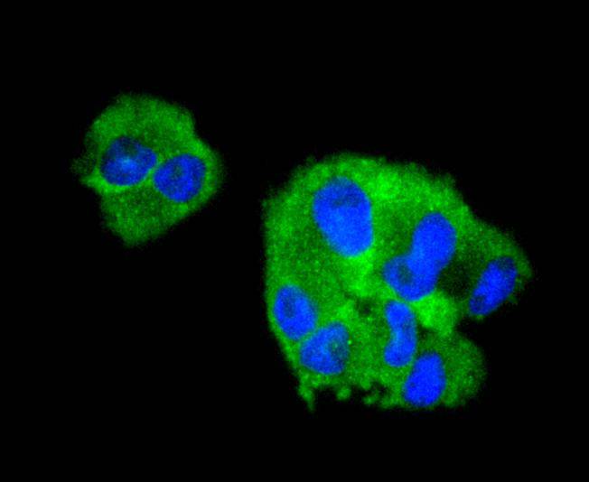 Collagen VI Rabbit mAb