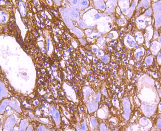Collagen VI Rabbit mAb