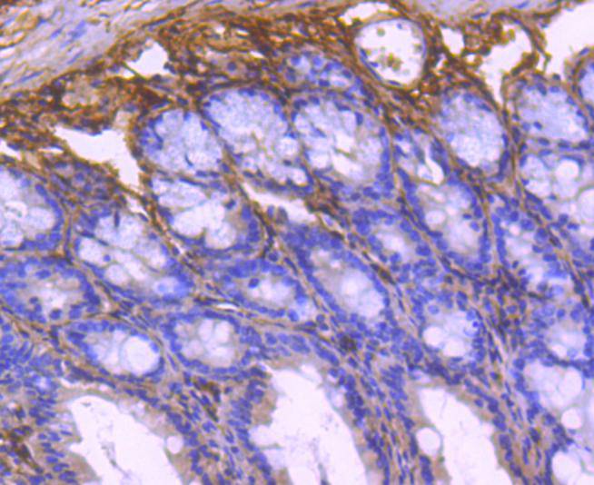 Collagen VI Rabbit mAb