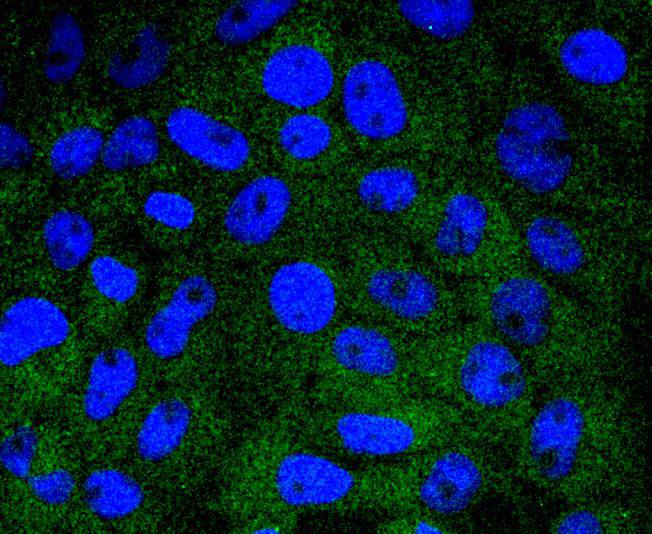 HSPA14 Rabbit mAb