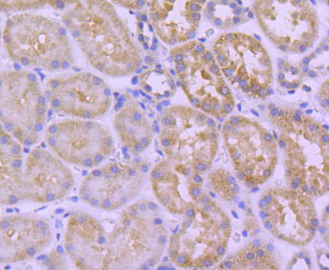 HSPA14 Rabbit mAb