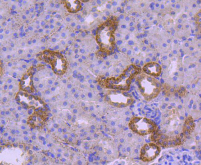 HSPA14 Rabbit mAb