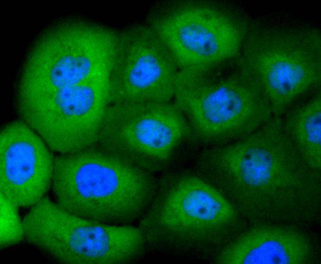 14-3-3 alpha+beta Rabbit mAb