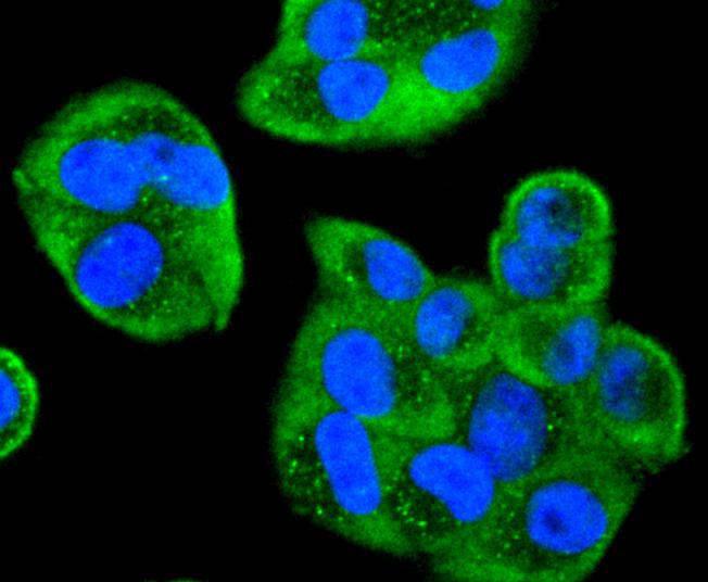 Cdc34 Rabbit mAb