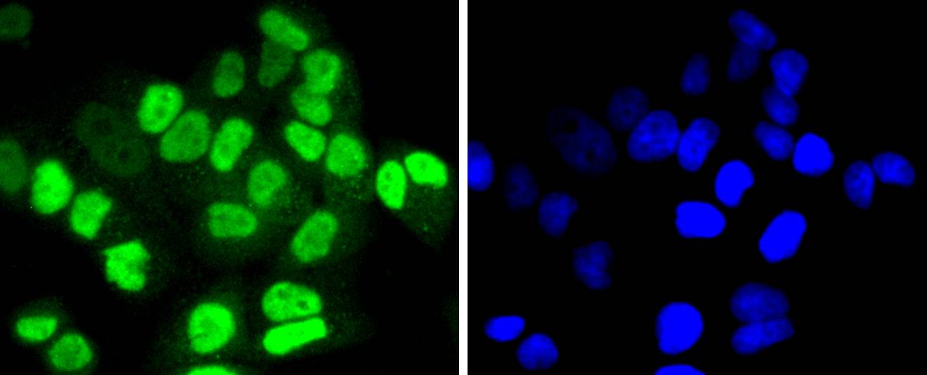 HDAC8 Rabbit mAb