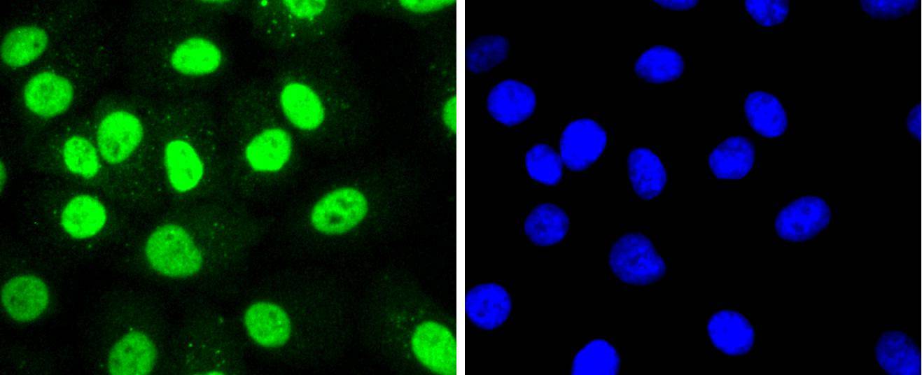 HDAC8 Rabbit mAb