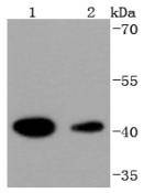 HDAC8 Rabbit mAb