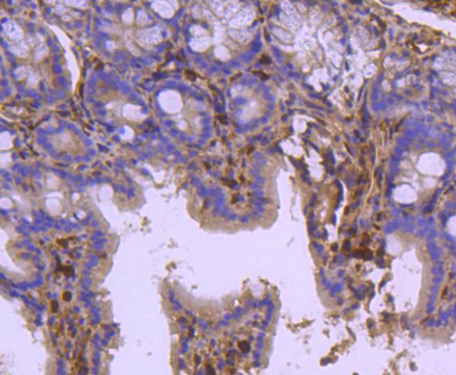 HSPA2 Rabbit mAb