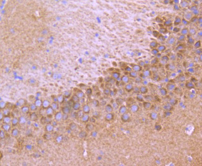 TrkA+B+C Rabbit mAb