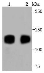 TrkA+B+C Rabbit mAb