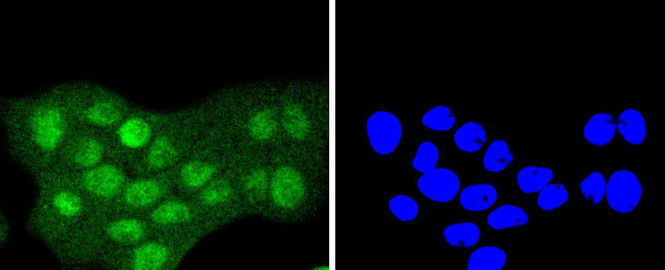 Sumo 2+3 Rabbit mAb