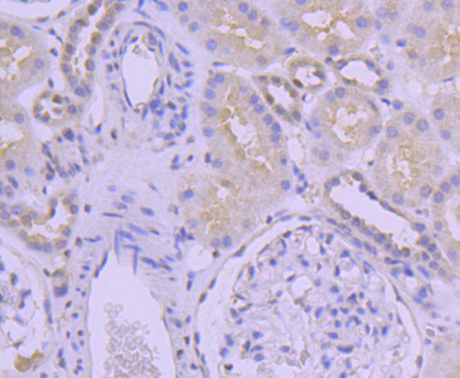 Sumo 2+3 Rabbit mAb