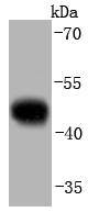 pro Caspase 9 Rabbit mAb