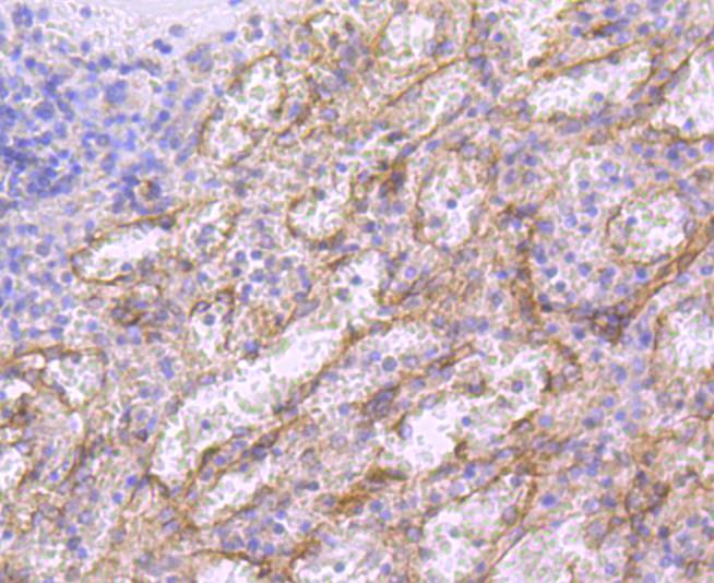CD36 Rabbit mAb