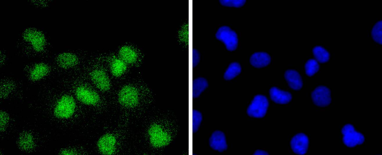 ATF1 Rabbit mAb
