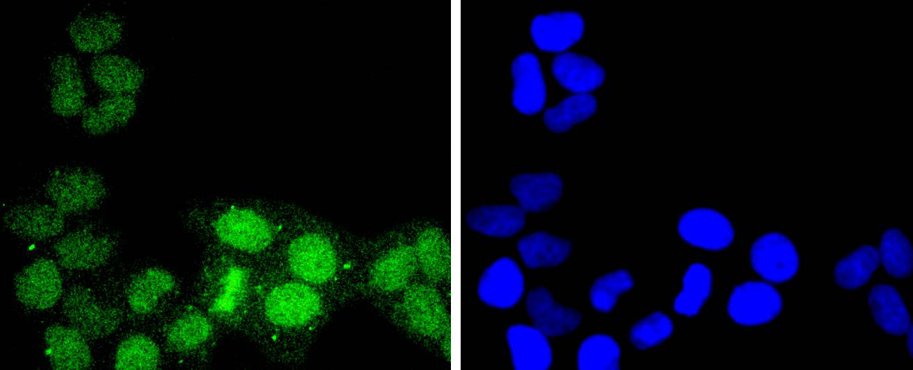 ATF1 Rabbit mAb