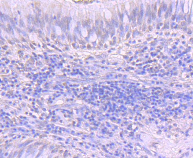 ATF1 Rabbit mAb