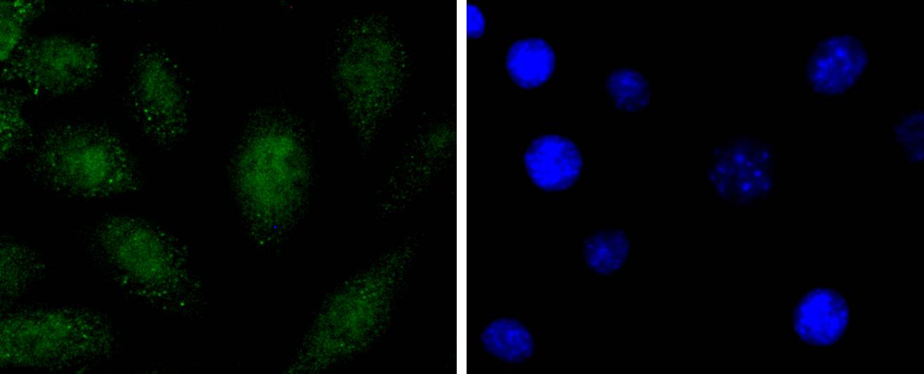 SOX1 Rabbit mAb