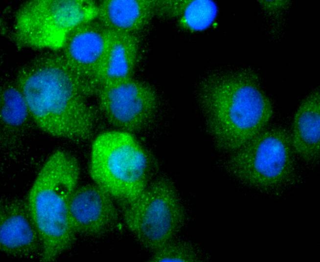 IL1 beta Rabbit mAb