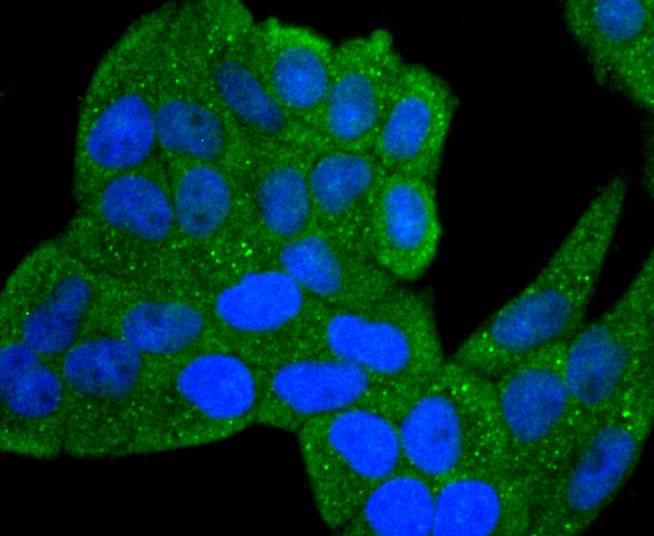 IL1 beta Rabbit mAb