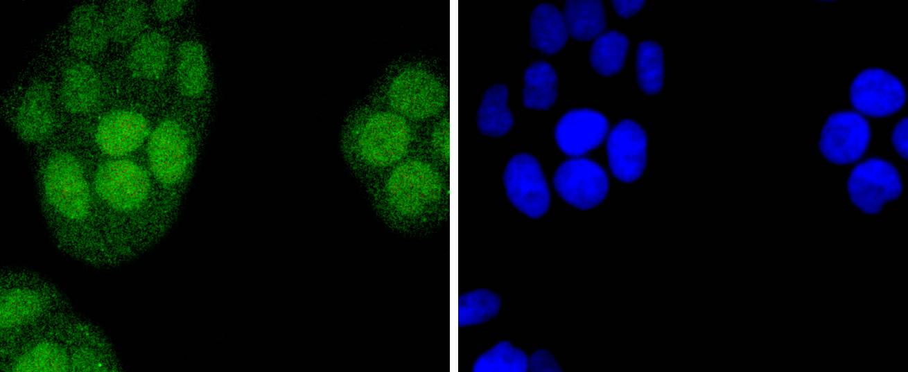 IRF2 Rabbit mAb