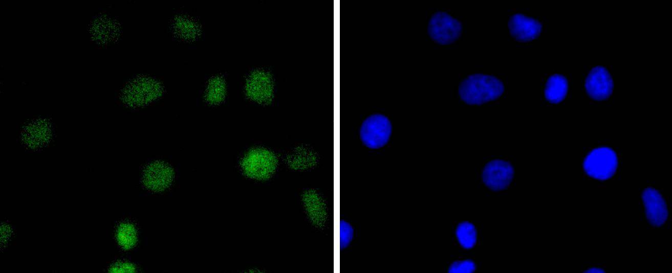 IRF2 Rabbit mAb